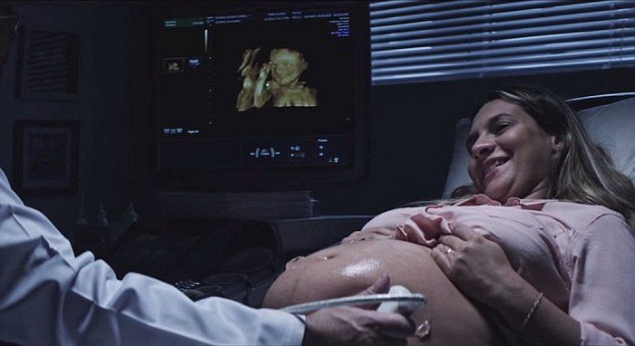 Tatiana listens to her unborn son's heartbeat during her ultrasound procedure.