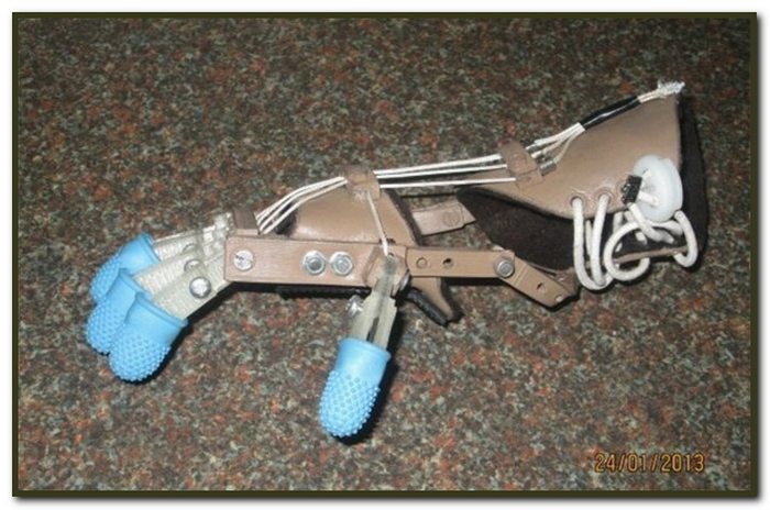 A cheap, 3D printed, open source articulated prosthetic hand