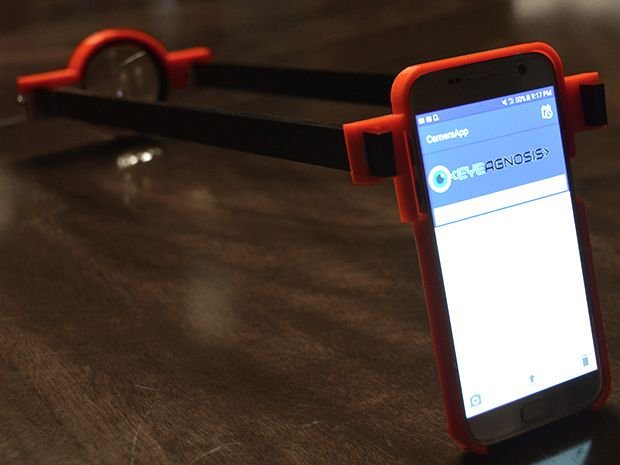 Kavya's 3D printed technology for diagnosing diabetic retinopathy