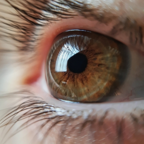 New 3D Printed Cornea: Hope for Clear Vision