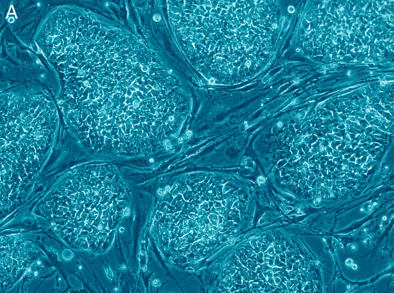 Scientists had earlier figured out how to create insulin-producing cells out of human stem cells.