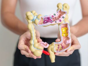 An image of a person holding a colon model for an article about colonic irrigation.