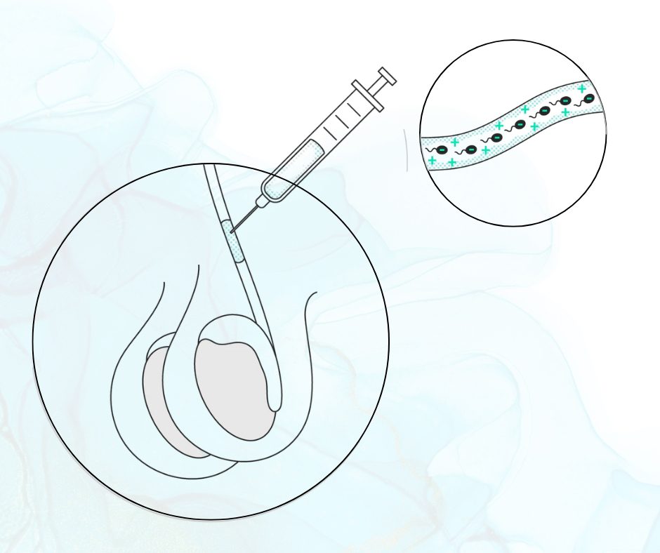 male birth control_00