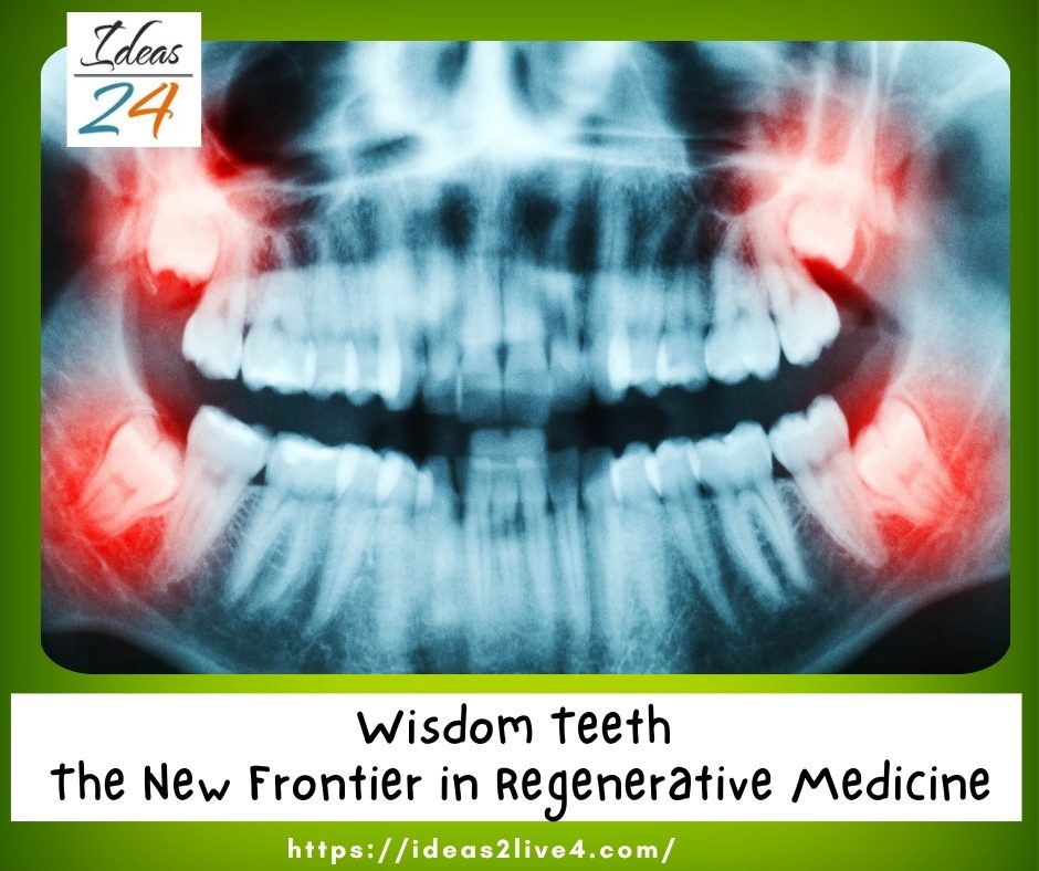 Wisdom Teeth: The New Frontier in Regenerative Medicine
